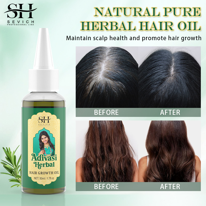 Ayurvedische Haargroei Olie Ad - Coconut Oil Refined recensie en prijs